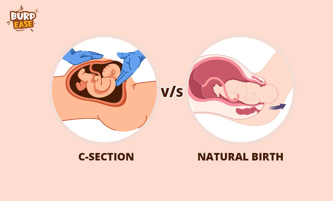 natural birth vs cesarean