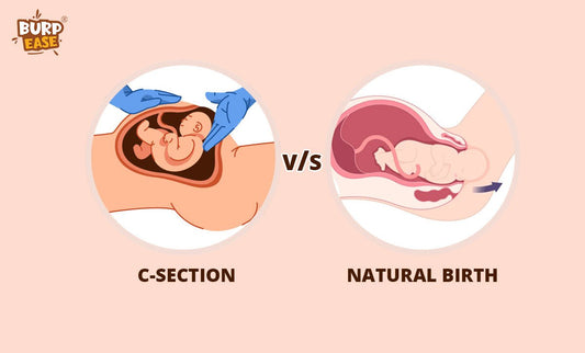 Natural Birth v/s Cesarean Birth… and a few do's and don’ts of parturition - The Burpease
